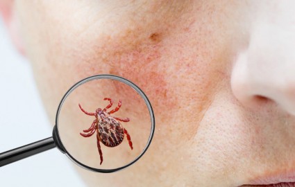 Zeckenbiss statt Zahnschmerz