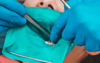 Kofferdam: bakterienfrei